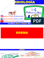 Edema - Soplos - Palpitaciones
