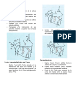 Cefalograma Lateral de Rickets