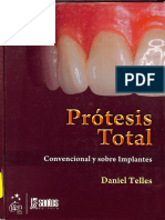 Protesis Total Telles