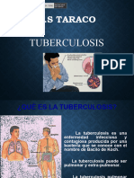 TUBERCULOSIS EXPOS