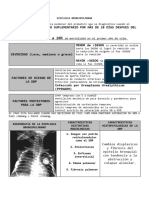 Displasia Broncopulmonar