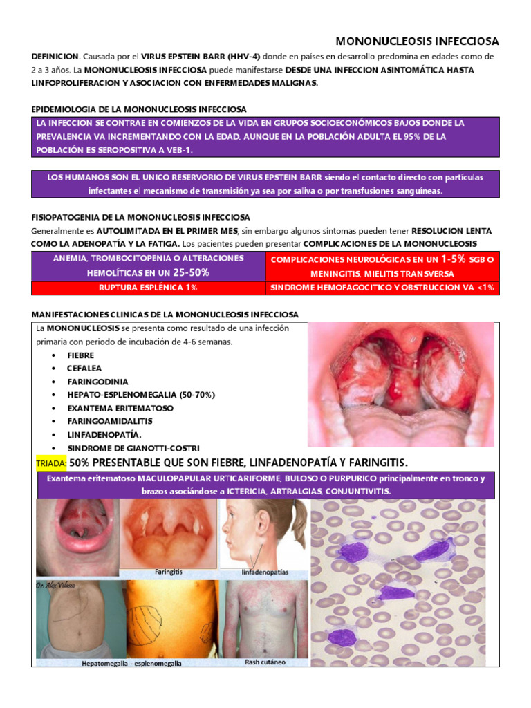 Síntomas y Tratamiento de Mononucleosis | PDF | Epidemiología ...