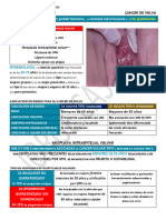 Cancer de Vulva: Ca Vulvar 4to Tipo de Cáncer Genital Femenino. Variedad Más Frecuente