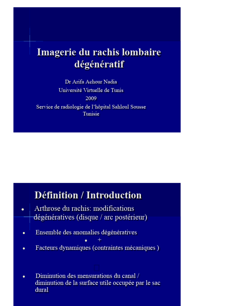 Imagerie du rachis lombaire dégénératif | PDF | Vertèbre | Maladies et ...