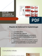 5etape de Tratament in Implantologie