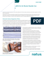 RevB - Case Study - Monitoring aEEG in A Newborn - ES - WEB