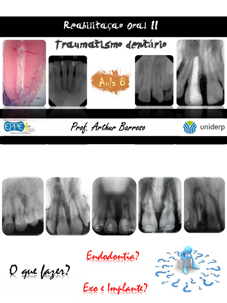 Aula+Trauma+Part+1 2 | PDF | Dente humano | Odontologia