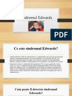 Sindromul Edwards