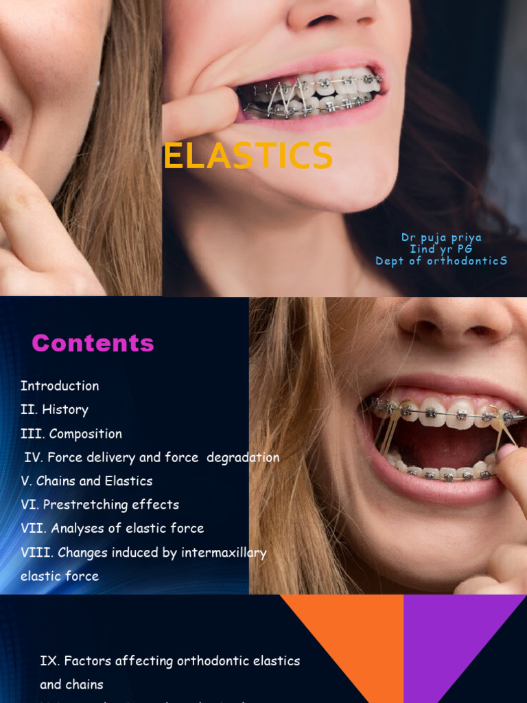 Elastics in Orthodontics PDF Polymers Natural Rubber