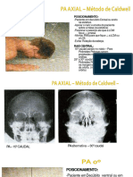 anatomia radiologica do crânio 2