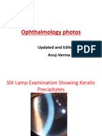 Opthalmology Photos