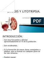 Litiasis y Litotripsia Presentacion