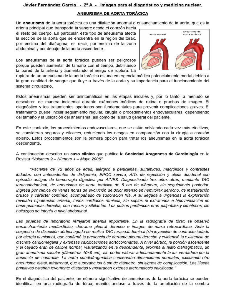 Aneurisma de Aorta Torácica: Diagnóstico y Tratamiento | PDF | Aorta ...