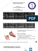 Hipoglucemia