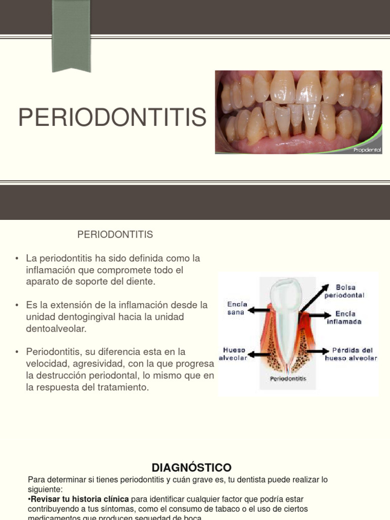 Definición y Tratamiento de Periodontitis | PDF | Medicina | Ciencias ...