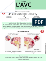 Fiche Explicative - L - AVC