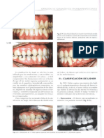 Nomenclatura Malposiciones Dentales de Lisher