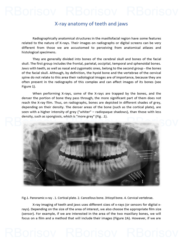 X-ray Anatomy of Teeth and Jaws | PDF | Human Nose | Radiography
