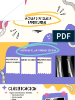 Fractura Diafisiaria Radiocubital