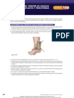 101 - Alargamiento Del Tendón de Aquiles Técnicas de Zetaplastia y Percutánea