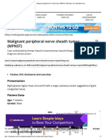 Malignant Peripheral Nerve Sheath Tumor (MPNST) - Radiology Case