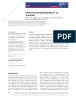 72_Progressive multifocal leukoencephalopathy in an immunocompetent patient