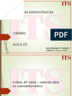 02 Crânio AP Axial - Método Hirtz Ou Submentovértce