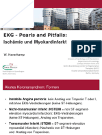 EKG - Pearls and Pitfalls: Ischämie Und Myokardinfarkt: W. Haverkamp