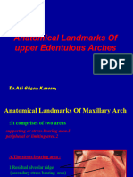 Anatomical Landmarks of Upper Edentulous Arches