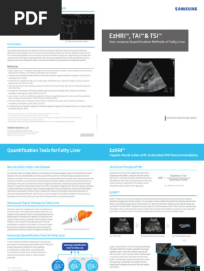 200304_Tech Leaflet_Liver Qunatification Tools for Fatty Liver