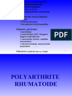 1- Polyarthrite Rhumatoide