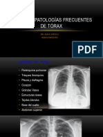 Clase 13 Patologías Frecuentes Del Tórax.