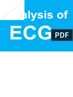 Analysis of ECGs