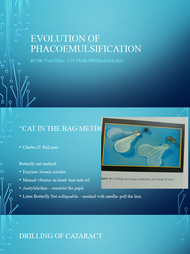 Evolution of Phacoemulsification Techniques | PDF | Social Science ...