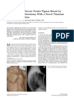 Brichon2010correction of A Severe Pouter Pigeon Breast BT Triple Sternal Osteotomy With A Novel Titanium Rib Bridge Fixation