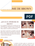 Sindrome de Brown