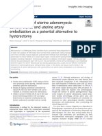 Management of Uterine Adenomyosis: Current Trends and Uterine Artery Embolization As A Potential Alternative To Hysterectomy