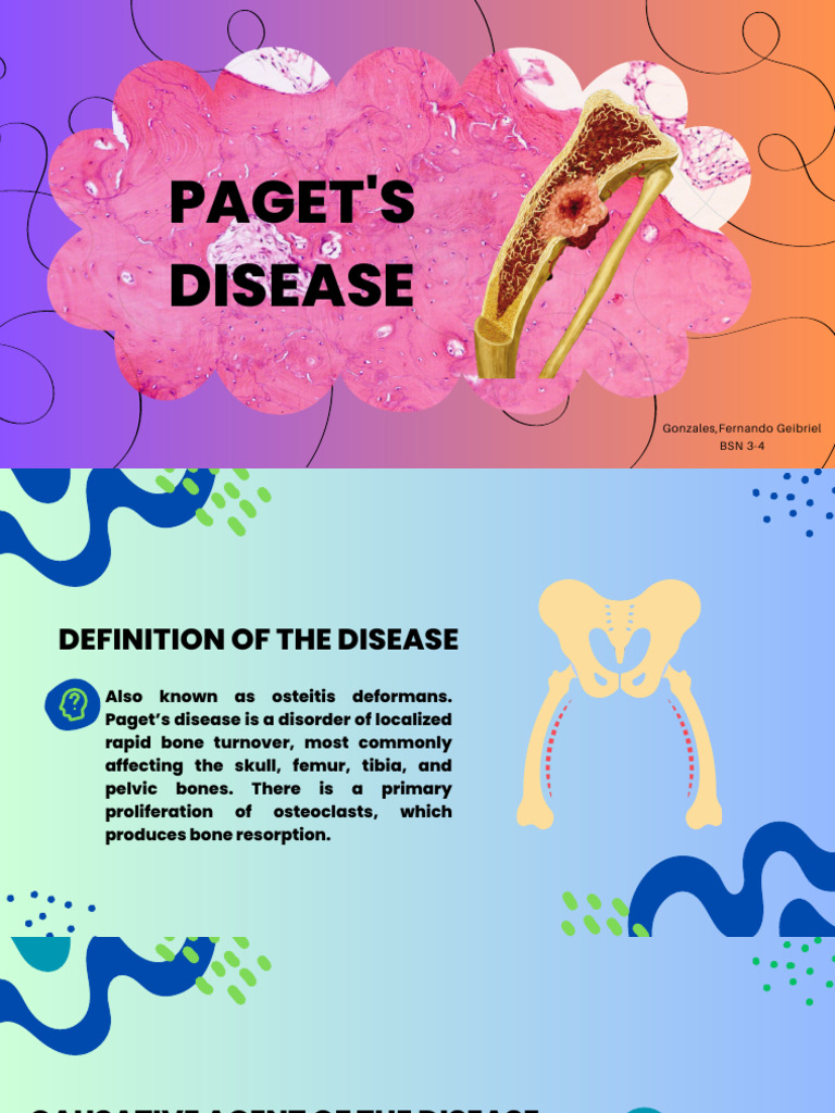 Paget's Disease PDF Bone Pelvis
