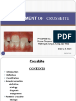 Management of Crossbite