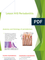  Periodontitis
