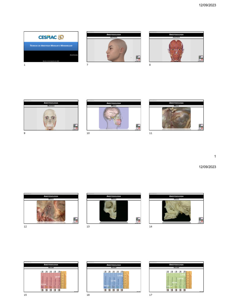 Técnicas de Anestesia Maxilar e Mandibular | PDF | Dente humano ...