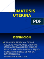 MIOMATOSIS UTERINA(2)