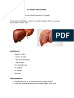 El Higado y El Alcohol