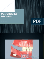 Malposiciones Dentarias