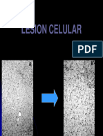 Lesion Celular