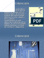 Colposcopía