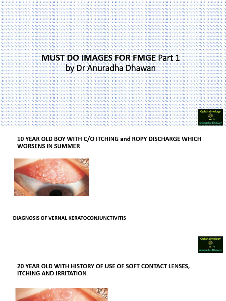 Ocular Risks From Orbital and Periorbital Radiation Therapy: A Critical  Review - International Journal of Radiation Oncology, Biology, Physics, image size:768x1024