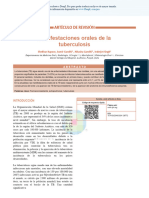 Oral - Manifestations - of - Tuberculosis Es