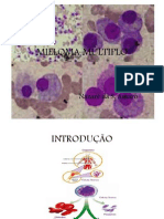 Mieloma Múltiplo: Diagnóstico e Tratamento