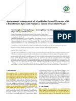 Apexification Management of Mandibular Second Premolar With